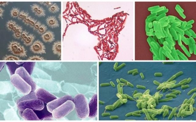 Giải mã khả năng sinh tồn của vi sinh vật trong điều kiện khắc nghiệt nhất